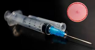 झापामा ‘सिरिन्ज’ आक्रमण : एक जनाको मृत्यु