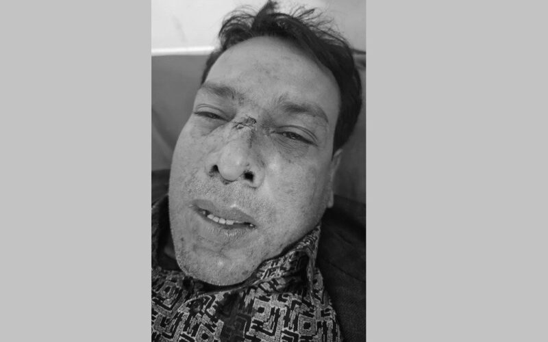 निर्वाचन प्रचारका क्रममा आजपाकी उम्मेदवारमाथि आक्रमण